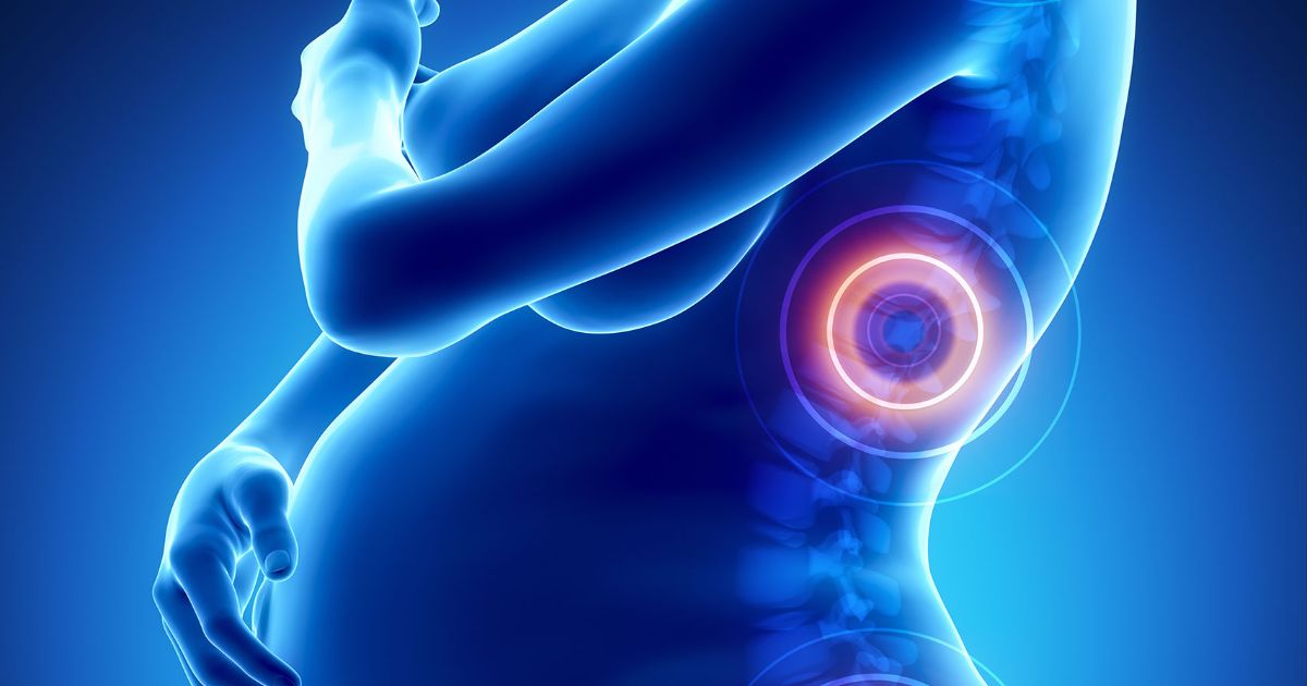 Back Pain During Pregnancy: Causes and Treatments